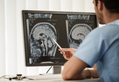 Understanding Glioblastoma: Symptoms, Diagnosis & Treatment