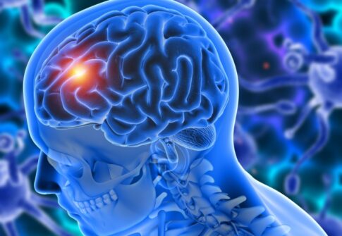 Living with a Brain Tumor: Patient Insights & Recovery Tips